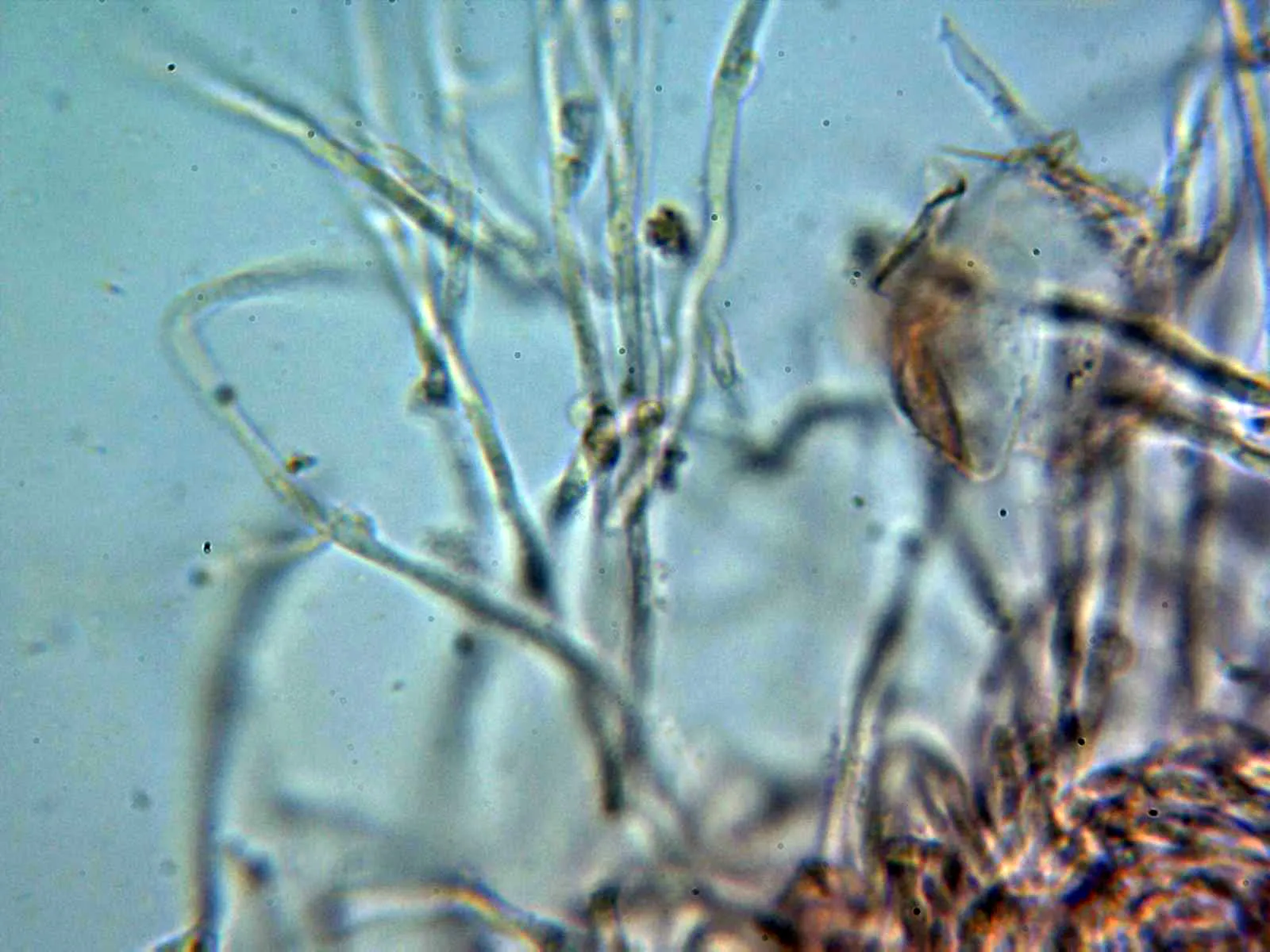 Microscopía de Lentaria epichnoa - 7 - Hifa con fíbula